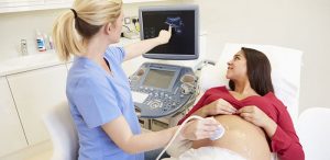A woman is having a private ultrasound scan and the sonographer is pointing at the sonogram on the ultrasound scanner