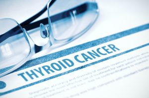 Ultrasound for thyroid cancer in London